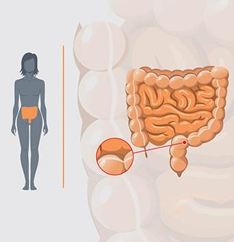 Image - fecal microbiome